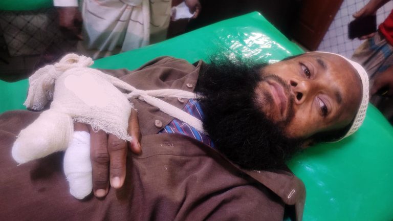 মঠবাড়িয়ায় পরকীয়া নিয়ে বিরোধে চাচাত ভাইয়ের আঙ্গুল কর্তন !